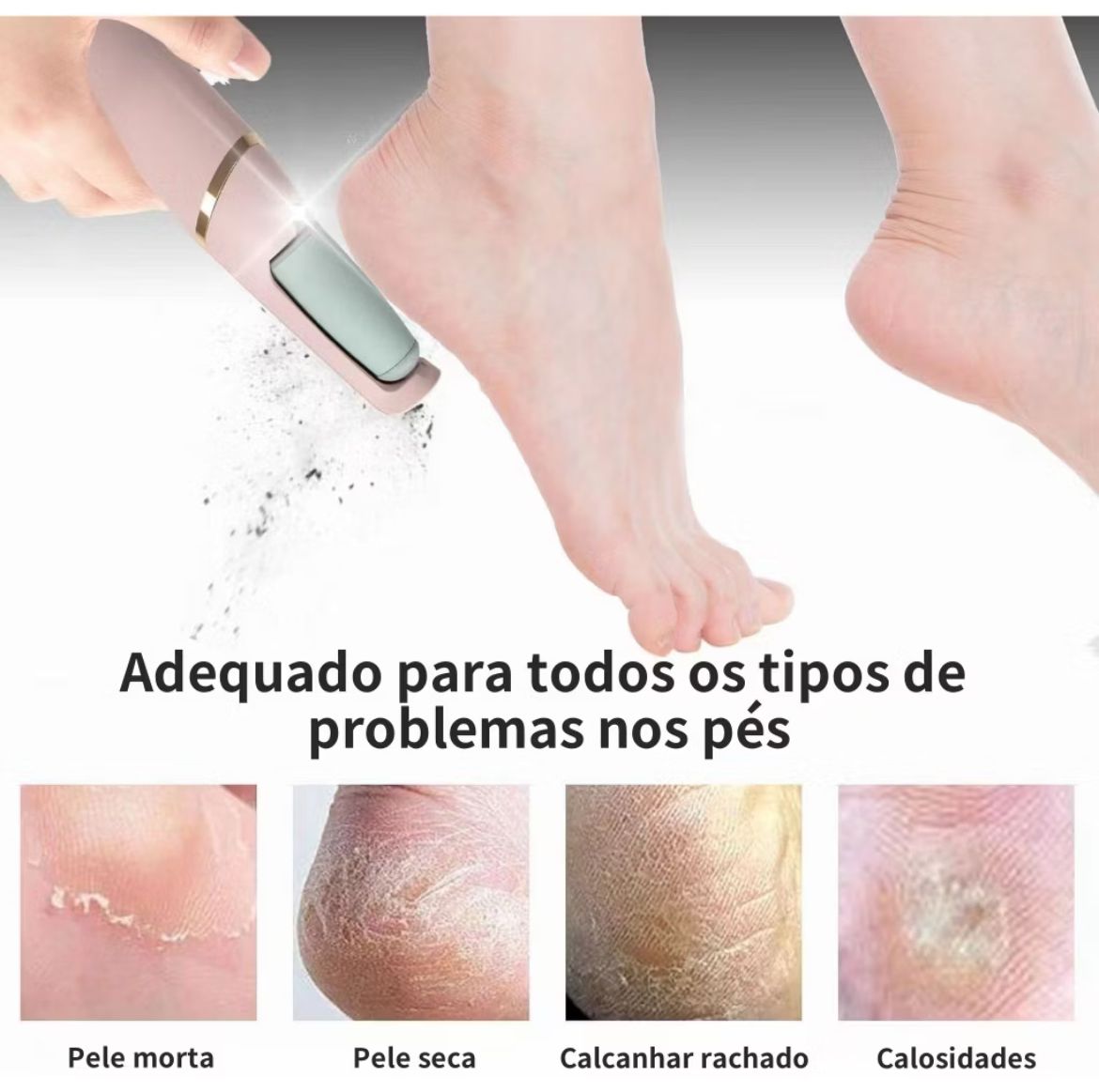 REMOVEDOR DE CALOS PORTÁTIL