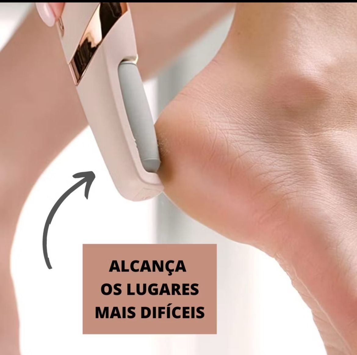 REMOVEDOR DE CALOS PORTÁTIL