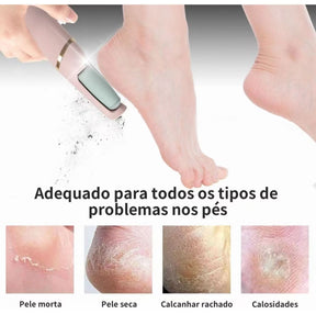 REMOVEDOR DE CALOS PORTÁTIL